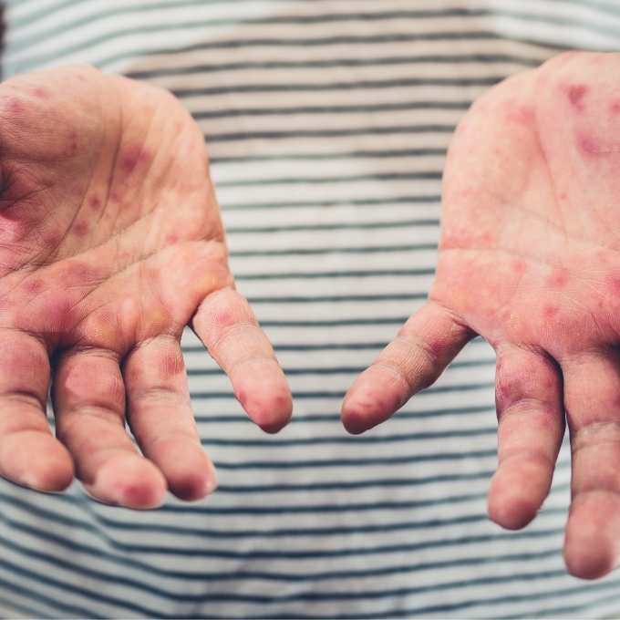 Wisconsin Biohazard & Trauma Cleanup Services Wisconsin Biohazard & Trauma Cleanup Services